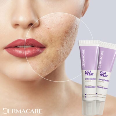 DERMACARE Cicatreat Creme Reparatrice