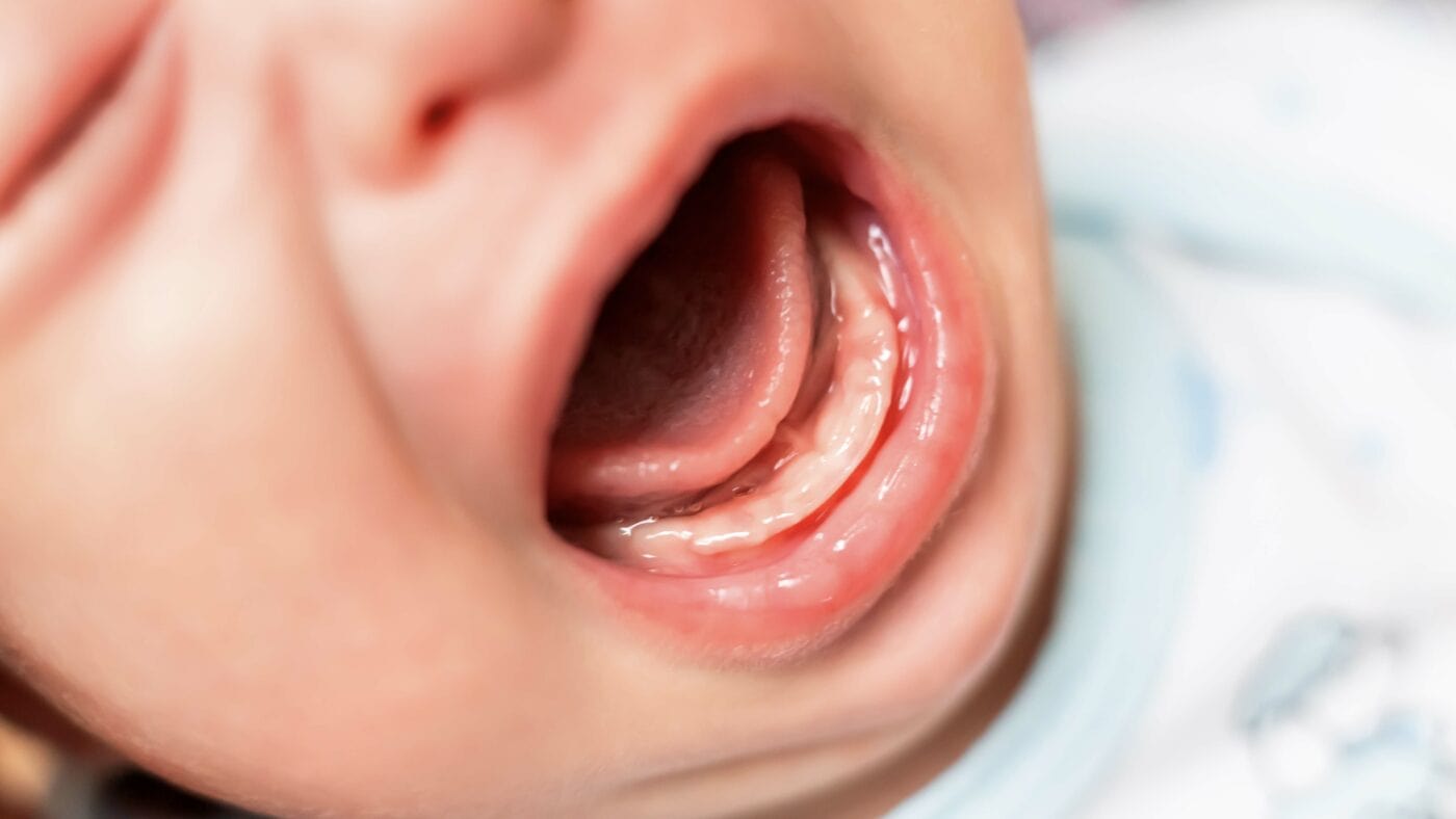 Bébé fait ses dents : comment le soulager ? - MaPara Tunisie
