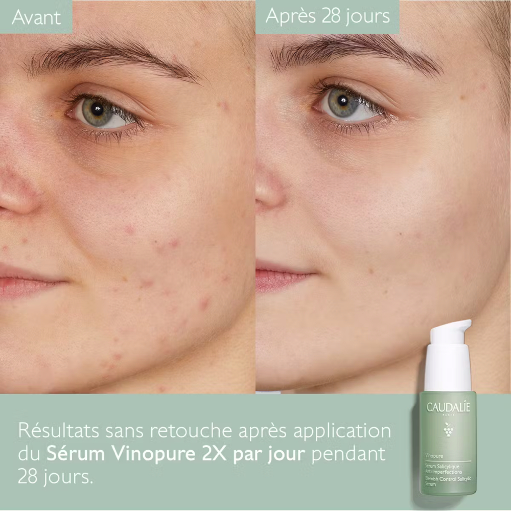 Caudalie vinopure sérum salicylique anti-imperfections 30ml