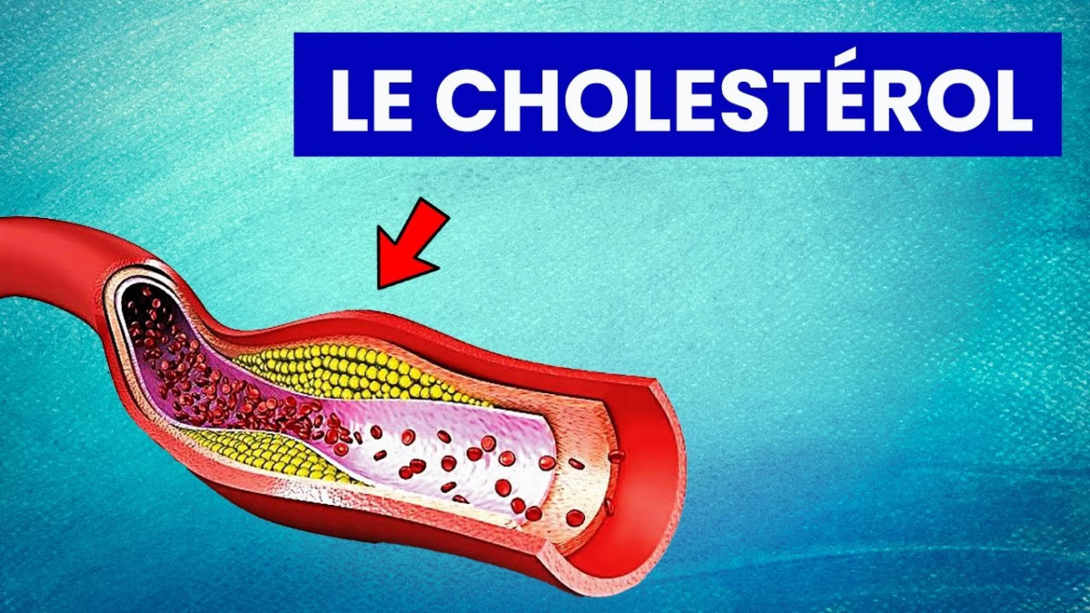 Cholestérol